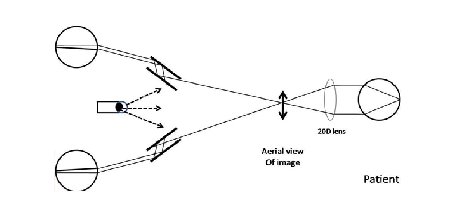 Binocular indirect ophthalmoscopy technique