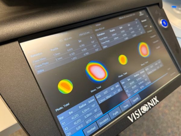 Rodenstock DNEye Scanner 2+ PLUS - Image 4