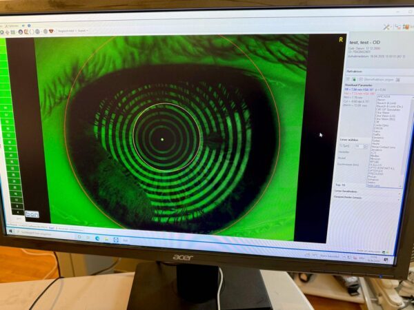 CSO Sirius Corneal Topographer Scheimpflug Camera for the price buy in ...